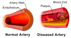 Lung-on-chip- schema of blood clot