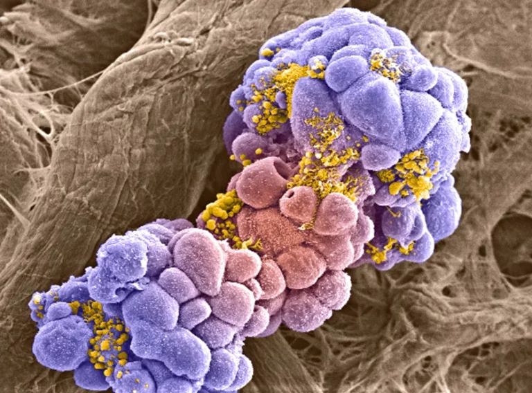 breast-cancer-cell-organoid