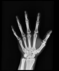 in vitro bone model hand