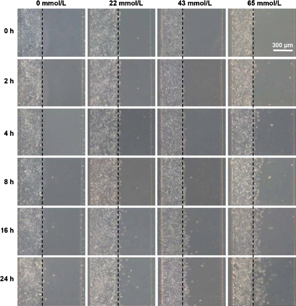 on chip cell migration ethanol and breast cancer