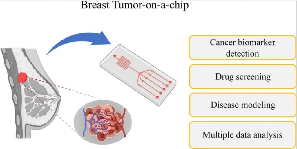 Breast tumor-on-a-chip