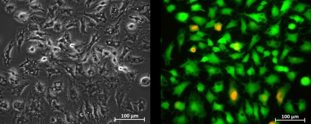 U-251 MG GFP cells cultured in a microfluidic chip with constant recirculated flow