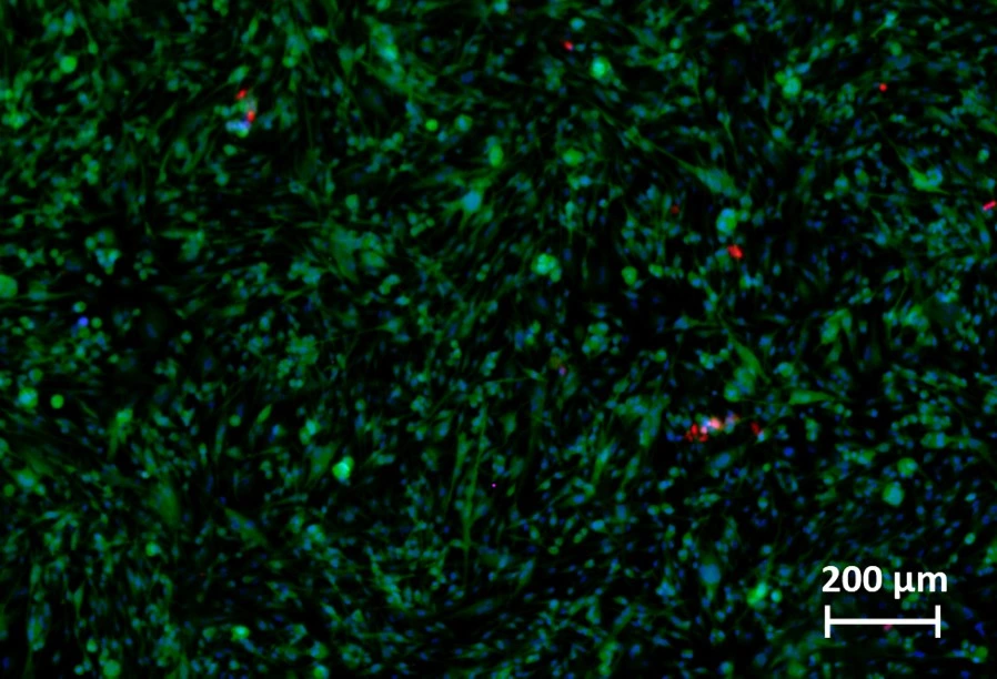 gioblastoma cells perfusion