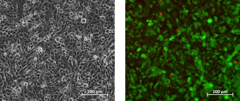 U-251 MG GFP cells after 24h cell perfusion